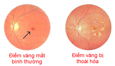 thoai-hoa-diem-vang