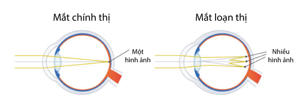 loan-thi