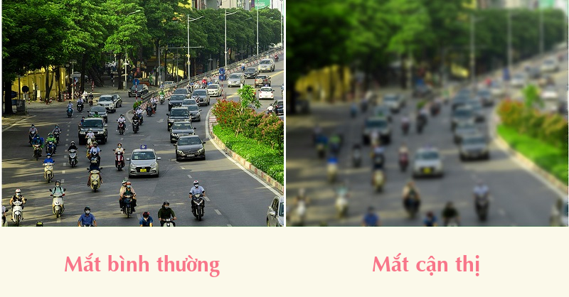 Tầm nhìn của người cận thị Tầm nhìn của người cận thị