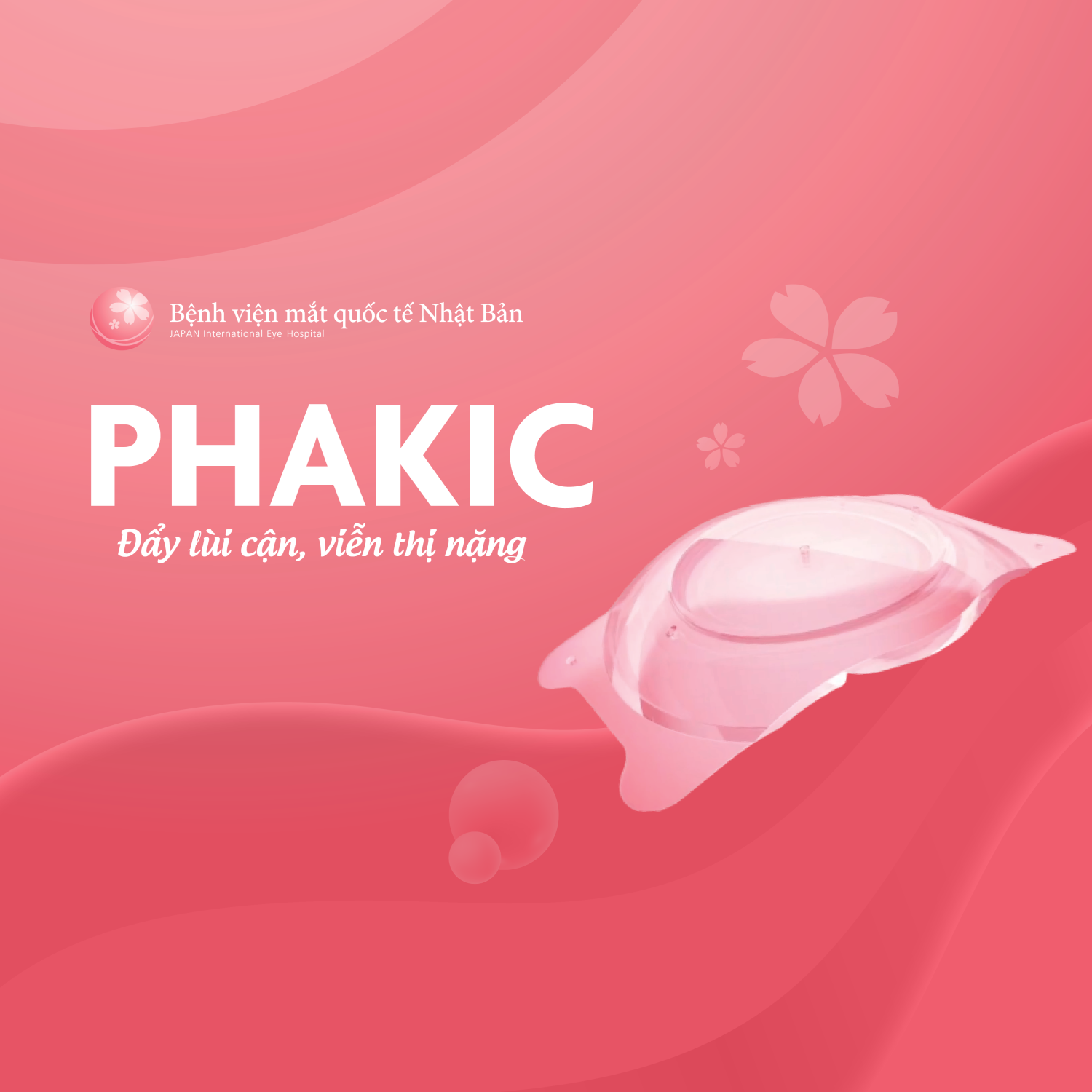 HIỂU VỀ PHẪU THUẬT ĐẶT THẤU KÍNH NỘI NHÃN - PHAKIC 