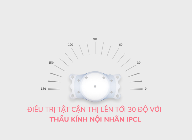 ĐIỀU TRỊ TẬT CẬN THỊ LÊN TỚI 30 ĐỘ VỚI THẤU KÍNH NỘI NHÃN IPCL