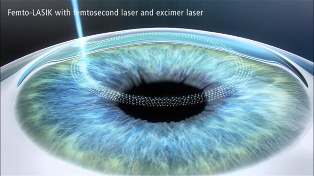 femtosecond femtosecond