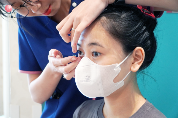 đeo kính ortho k deo-kinh-ortho-k
