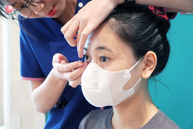 deo-kinh-ap-trong-cung-OrthoK