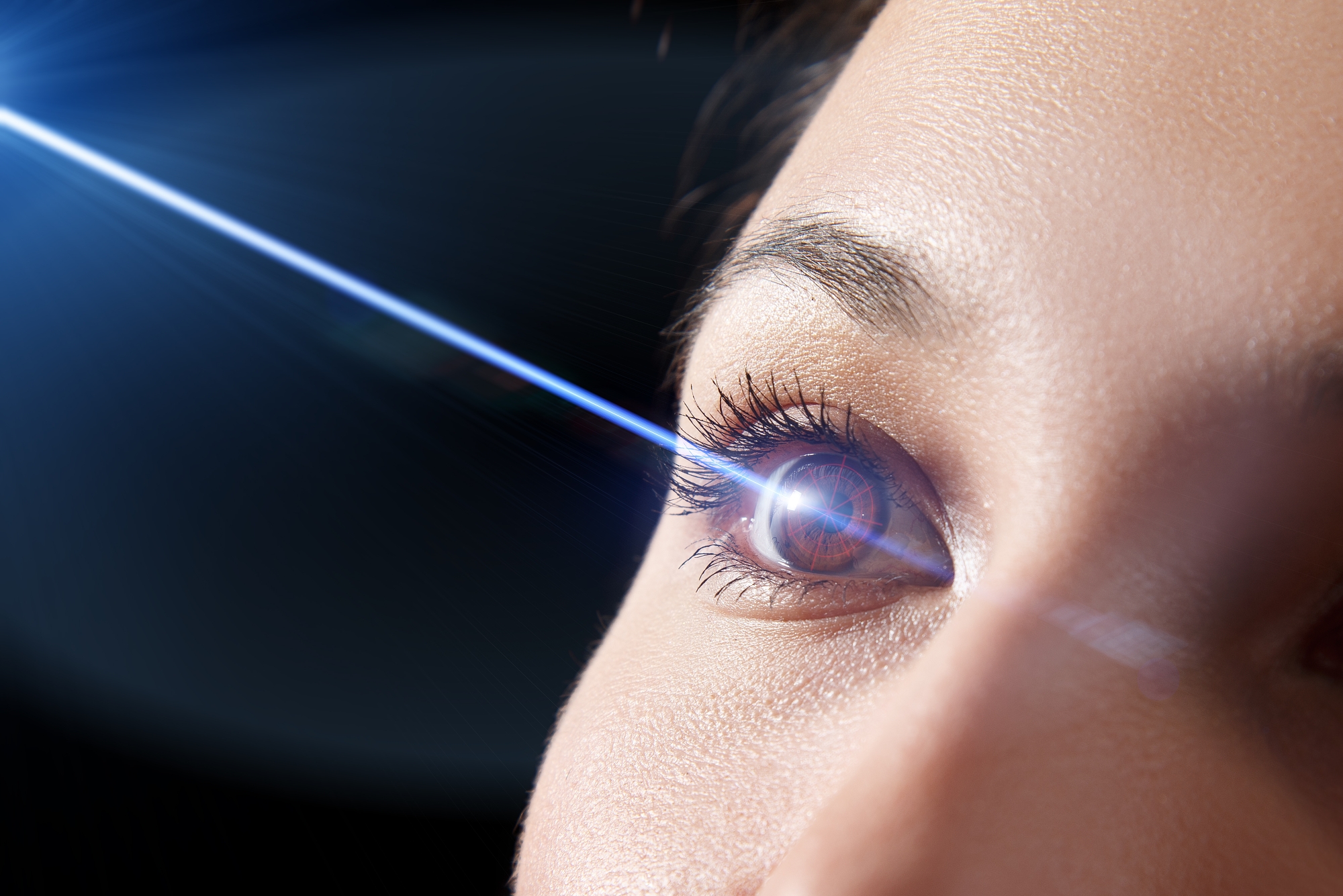 So sánh 4 phương pháp mổ cận bằng laser hiện đại: SILK, ReLEx SMILE, Femtosecond LASIK và SBK LASIK