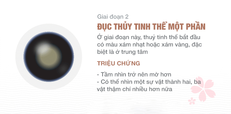 giai-doan-duc-thuy-tinh-the