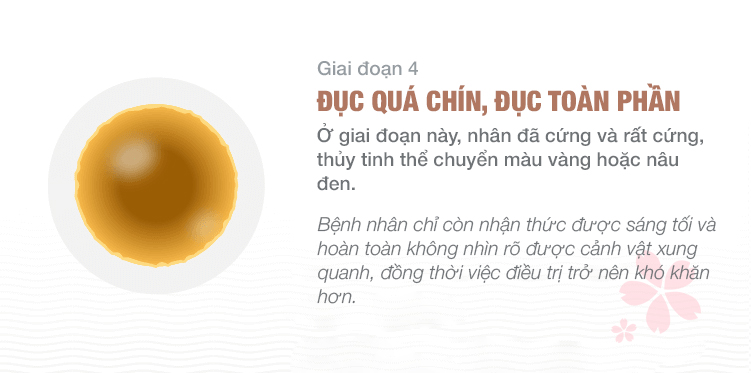 giai-doan-duc-thuy-tinh-the