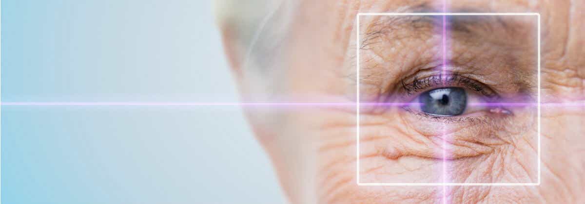 phau-thuat-laser-cataract