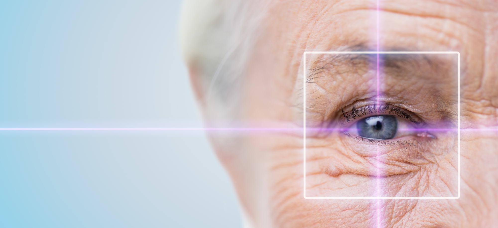 laser-cataract
