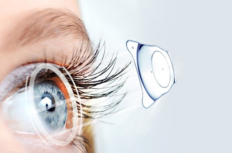 Mắt kính có kích thước phù hợp cho người cận 10 độ là bao nhiêu?
