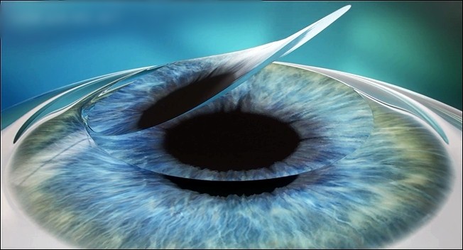 4.  Return the corneal flap to its original position and complete the surgery.