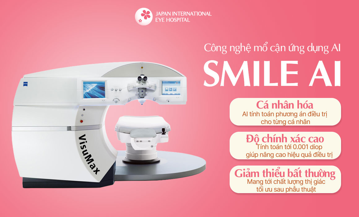 ReLEx SMILE AI - Công nghệ mổ cận ứng dụng Trí tuệ nhân tạo AI